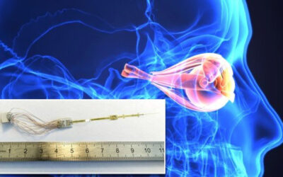 Estimulación del nervio óptico para dar visión a los ciegos