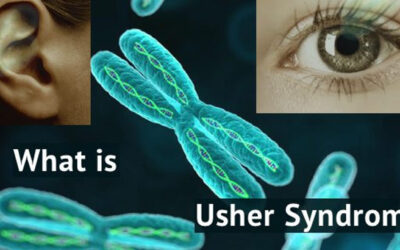 Retina International Special Interest Group (SIG) on Usher Syndrome