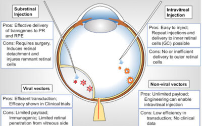 AAV8-RGPR para Retinosis Pigmentaria ligada al cromosoma X