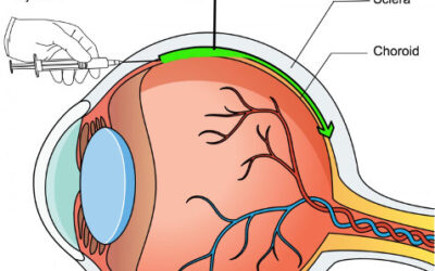 Terapia génica ocular de una forma más fácil y segura
