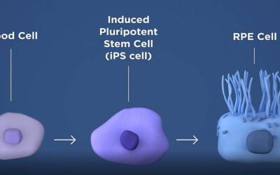 El Departamento de Salud y Servicios Sociales de los Estados Unidos lanza el primer ensayo clínico con células madre para reemplazar las células muertas en la retina