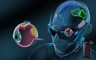 Nueva retina artificial BVT Bionic Eye