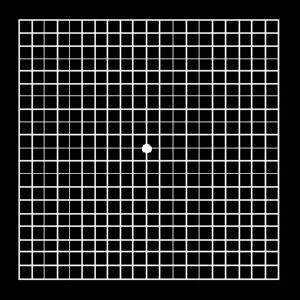 Rejilla de Amsler con fondo negro