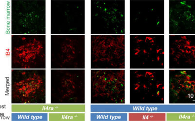 Científicos identifican un elemento inesperado que causa pérdida de visión en pacientes con DMAE