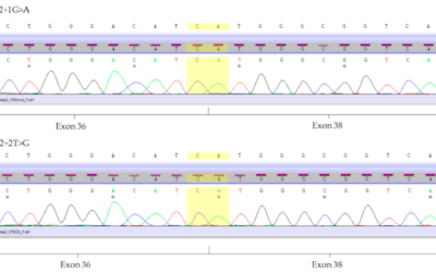 Análisis molecular de las mutaciones del gen ABCA4 en pacientes con la enfermedad de Stargardt usando folículos de pelo humano