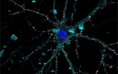 Prótesis de retina líquida artificial para contrarrestar los efectos de los trastornos oculares