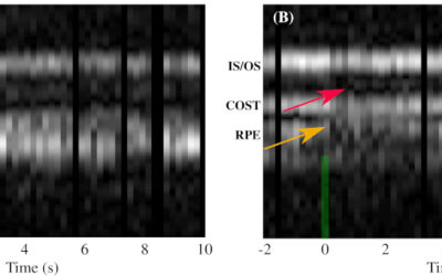 Optoretinograma: medición óptica de las respuestas de los fotorreceptores humanos a la luz