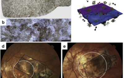 Trasplante de células madre de la retina: Conjugando seguridad y beneficios potenciales