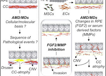 Modelo 3D para comprender la DMAE