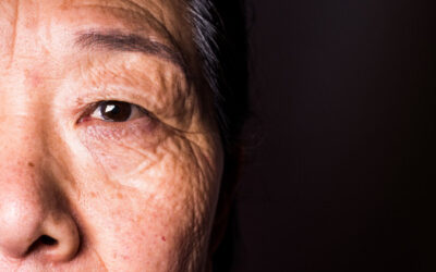 DMAE Degeneración macular asociada a la edad y genómica