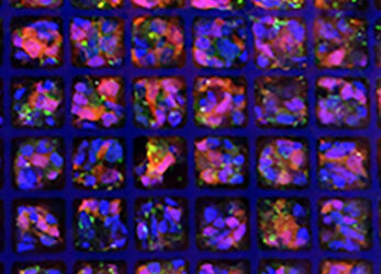 Una matriz con forma de cubitera siguiente paso para devolver la visión a retinas dañadas