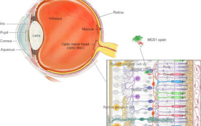 La terapia optogenética MCO de Nanoscope mejora la visión a 11 pacientes con Retinosis Pigmentaria