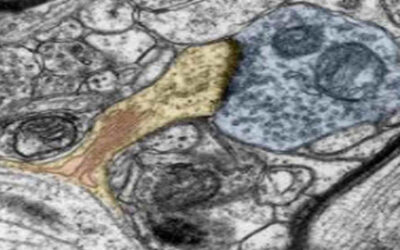 Alkeus Pharmaceuticals obtiene la designación de terapia innovadora para ALK-001 para el tratamiento de la enfermedad de Stargardt