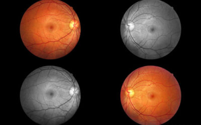 Conocer mejor la DMAE