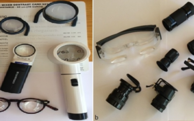Dispositivos de ayuda a la visión para la degeneración macular asociada a la edad (DMAE)