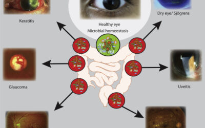 Influencia de la microbiota intestinal en las enfermedades oculares