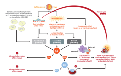 Pegcetacoplan de Apellis reduce el avance de las lesiones en la DMAE seca avanzada – Atrofia Geográfica