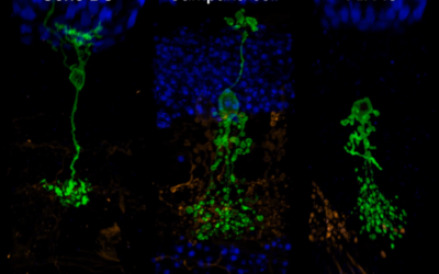 Descubierto un nuevo tipo de neurona en la retina