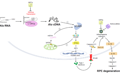 Descubren una acumulación tóxica en los ojos de pacientes con DMAE