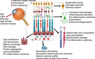 Impacto del estrés oxidativo y no oxidativo y de las lesiones en la DMAE