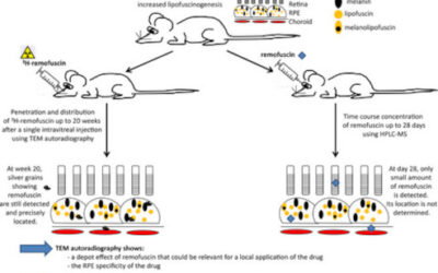 Soraprazan y repercusiones en el tratamiento de Stargardt y DMAE seca
