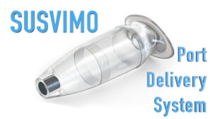 Susvimo, un enfoque terapéutico inédito para la degeneración macular neovascular (nDMAE)