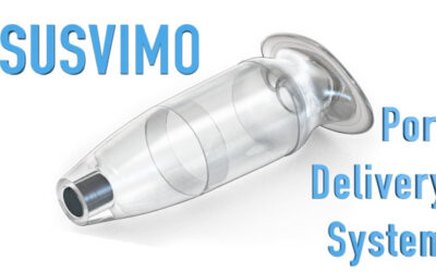 Susvimo, un enfoque terapéutico inédito para la degeneración macular neovascular (nDMAE)