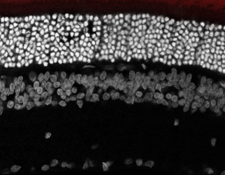 HyVIS: sinapsis híbridas para tratar las distrofias de la retina