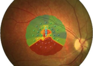 Locus retiniano preferido