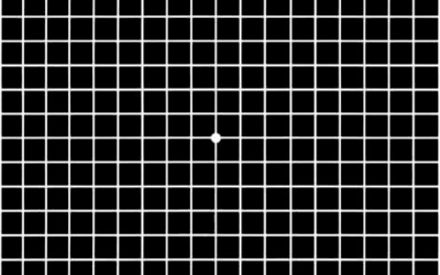 Degeneración macular húmeda asociada a la edad DMAE exudativa