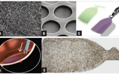 Una posible solución con células madre para la Atrofia Geográfica – DMAE seca