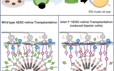 Una técnica perfeccionada de trasplante de retina está casi lista para los ensayos clínicos.