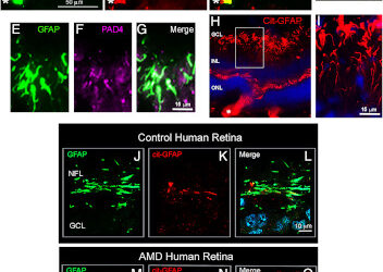 ¿Bloqueos que salvan la visión? Investigadores de la UConn lo analizan