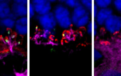 Terapia génica dirigida a las células bipolares ON revierte de forma estable la ceguera nocturna estacionaria congénita LRIT3 en perros