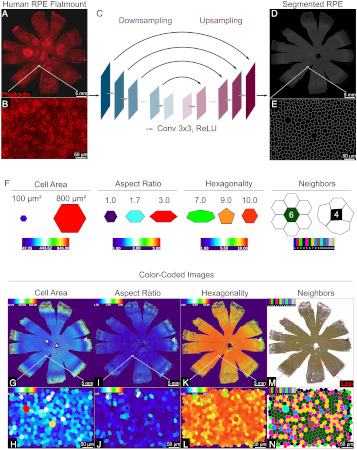 Mapa de resolución unicelular del epitelio pigmentario de la retina