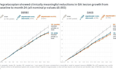 Pegcetacoplan mejora resultados en los estudios de fase 3 DERBY y OAKS para Atrofia Geográfica (DMAE seca)