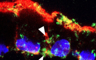 Investigadores del NatEyeInstitute han desarrollado un nuevo modelo de la enfermedad de Stargardt (ABCA4)