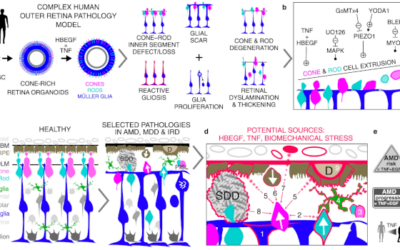 Descubierto un nuevo mecanismo que puede explicar la pérdida de visión en la DMAE