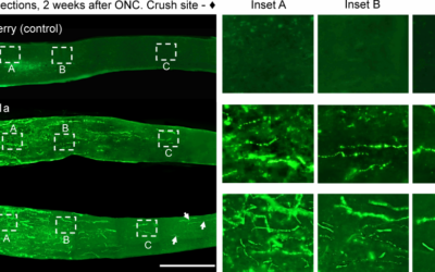 Nuevas investigaciones podrían ayudar en el futuro a curar ciertos tipos de ceguera y parálisis