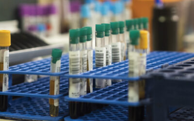 Terapias emergentes revolucionan ensayos clínicos de retinopatía diabética