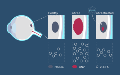 Desarrollo de una terapia génica HG202 basada en la modificación del ARN para la DMAE