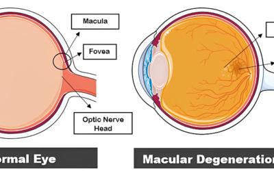 Las tendencias pueden cambiar el paradigma del tratamiento de la DMAE