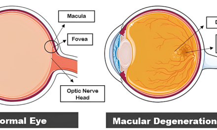 Las tendencias pueden cambiar el paradigma del tratamiento de la DMAE