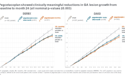 Resultados de 24 meses de los estudios de fase 3 de Syfovre para la Atrofia Geográfica (DMAE seca)