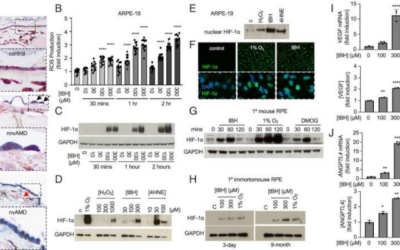 Estrés oxidativo e hipoxia afectan a la DMAE