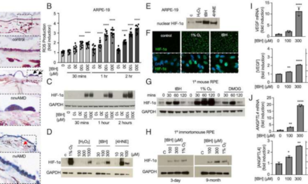 Estrés oxidativo e hipoxia afectan a la DMAE