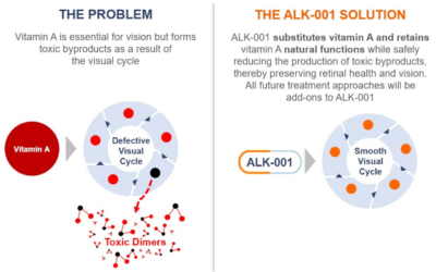 Gildeuretinol de Alkeus Pharmaceuticals detiene progresión de Stargardt según datos provisionales positivos
