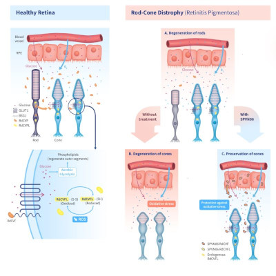 SparingVision culmina la fase final de escalado de dosis en el ensayo PRODYGY con SPVN06 para retinosis pigmentaria