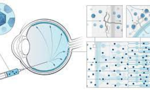 4DMT anuncia resultados alentadores del ensayo clínico de su terapia génica 4D-150 para DMAE húmeda