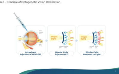 La terapia génica MCO-010 para la retinosis pigmentaria obtiene la aprobación de las autoridades reguladoras